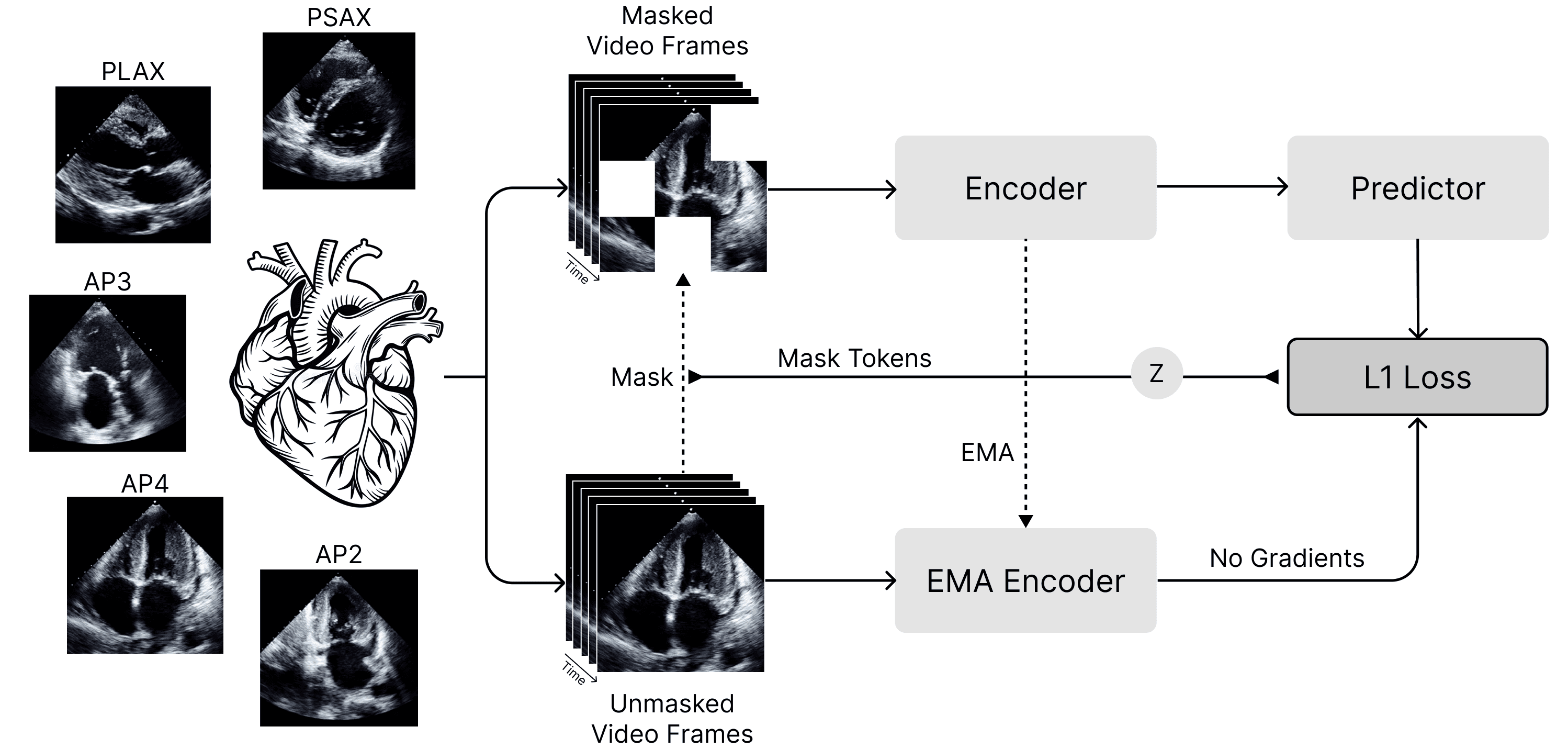 EchoJEPA Architecture